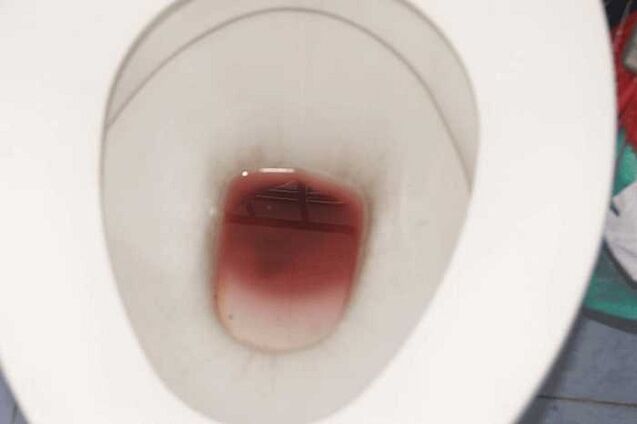 avvistamento negli uomini quando sono eccitati